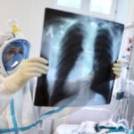 Від коронавірусної інфекції вилікувалося 10 313 вінничан, продовжує хворіти 1670
