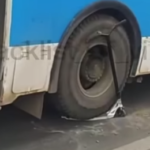Епідемія гепатиту А на Вінниччині: що таке гепатит А та як від нього захиститись?