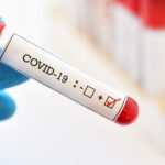 Плюс 32 нових випадки Covid-19 виявили за минулу добу на Вінниччині