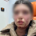 На Вінниччині підліток понівечив обличчя 13-річної дівчинки: що відомо про інцидент