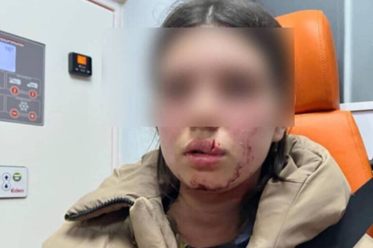 На Вінниччині підліток понівечив обличчя 13-річної дівчинки: що відомо про інцидент