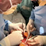 У Вінниці провели трансплантацію серця від померлого донора