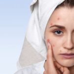 Обличчя карта здоров’я: про які хвороби можуть розповісти шкіра та висипання