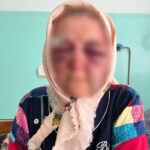 На Вінниччині сусід побив 87-річну жінку та забрав її заощадження