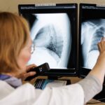 Вчасне лікування рятує: на Вінниччині фіксують нові випадки туберкульозу