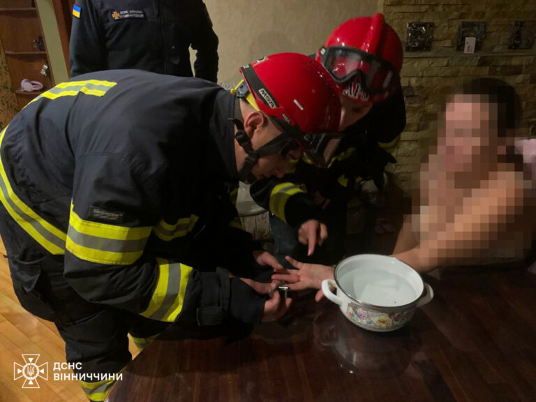 Обручка ледь не залишила вінничанку без пальця