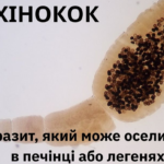 Ехінокок у Вінницькій області: що потрібно знати про «невидимого» паразита