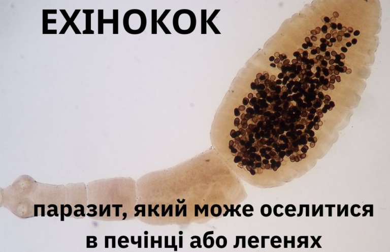 Ехінокок у Вінницькій області: що потрібно знати про «невидимого» паразита