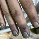 Обмороженнями та госпіталізацією завершилась незаконна спроба перетнути кордон