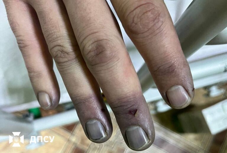 Обмороженнями та госпіталізацією завершилась незаконна спроба перетнути кордон