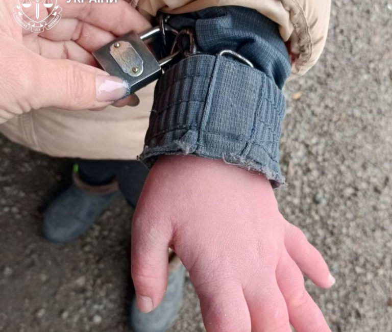На Кіровоградщині працівниця дитбудинку приковувала дівчину ланцюгами до ліжка