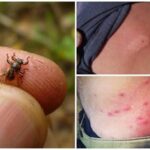 Не кліщ і не воша: що за дивна комаха зявилася на Вінниччині