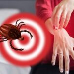 На Вінниччині у чотири рази зросла захворюваність на хворобу Лайма
