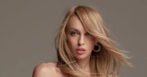 Полякова назвала імя ексдепутата Вінниці, який підпалив її житло та залишив шрами на все життя
