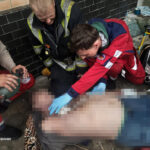 На Вінниччині за добу загинули двоє чоловіків через нещасні випадки